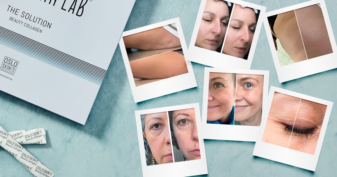 Collage di foto prima e dopo clienti